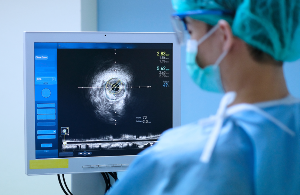 A nurse examines an ultrasound image.